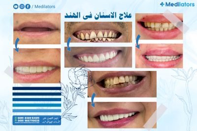Medilators-علاج-الاسنان-فی-الھند